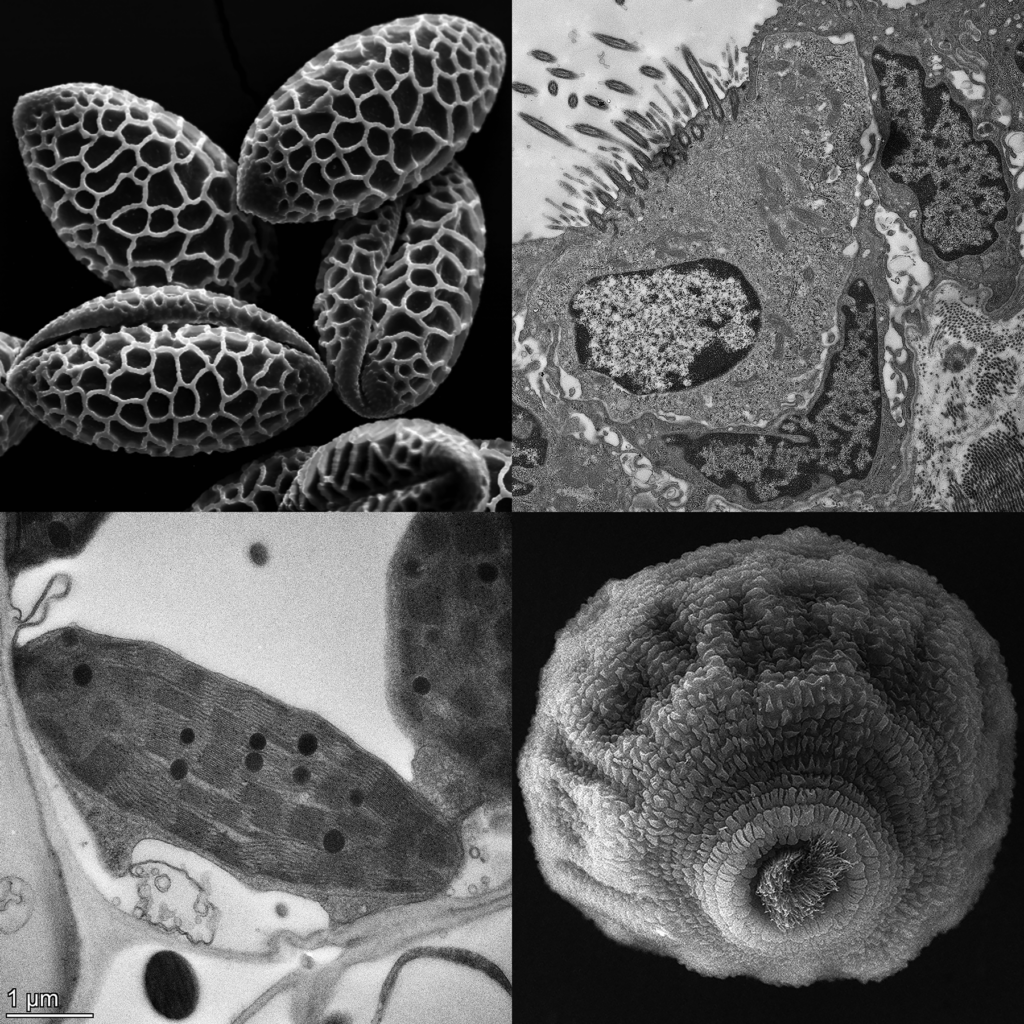Top left - SEM of Easter Lily pollen
Top right - TEM of ciliated epithelium of pig
Bottom left - TEM of chloroplast in corn leaf
Bottom right -  SEM of a protozoan ciliate