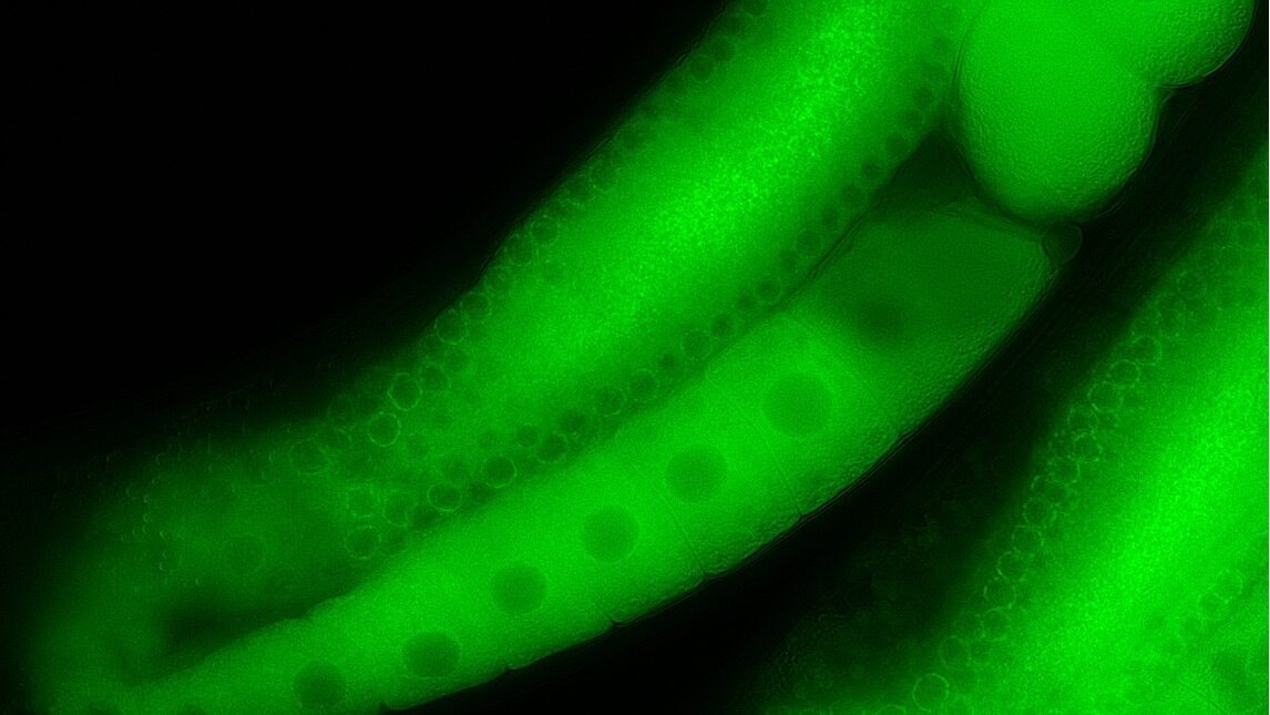 Image of C. elegans by Hayden Huggins