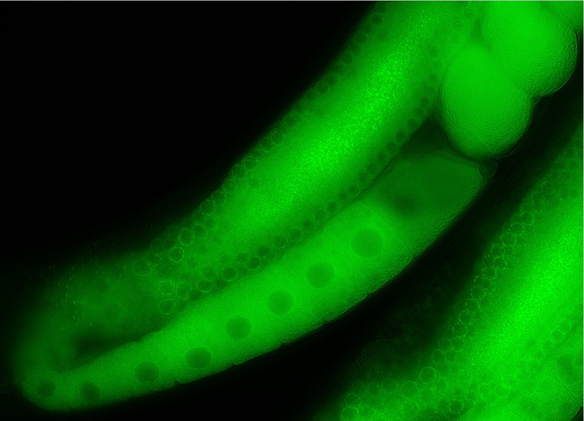 Image of C. elegans by Hayden Huggins